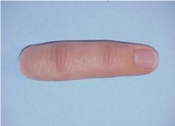 انگشت مصنوعی انگشت قطع شده  استفاده از پروتز  انگشتان مصنوعی  سیلیکون  جنس انگشت  پروتز انگشت پروتز انگشت خوب حفظ زیبایی  قطع عضو از بند اول و دوم انگشت یا انگشتانانگشت زیبایی